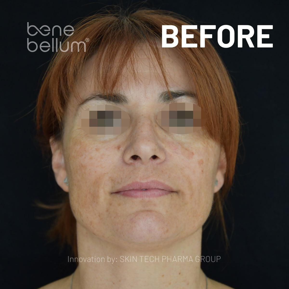 image comparison before