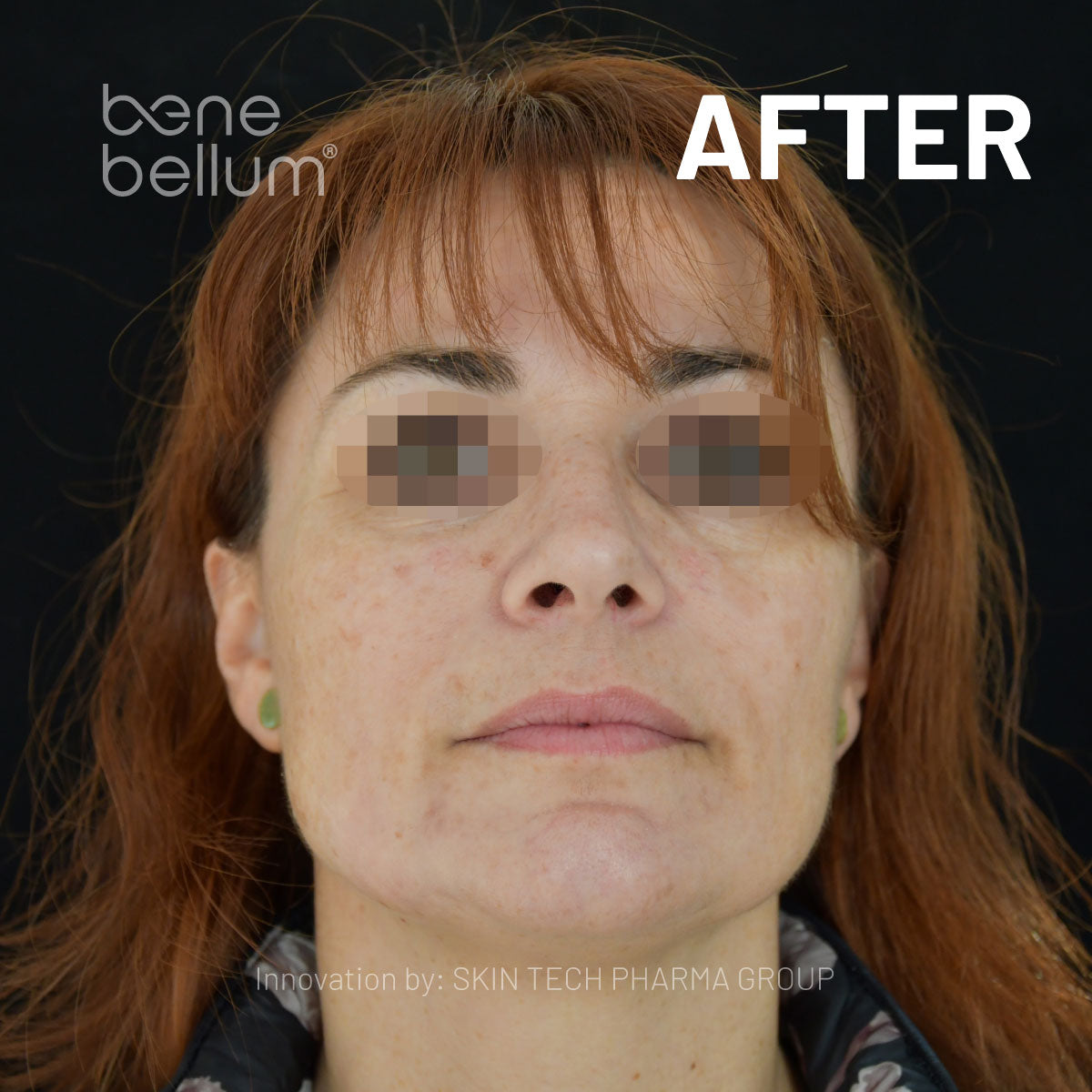 image comparison after